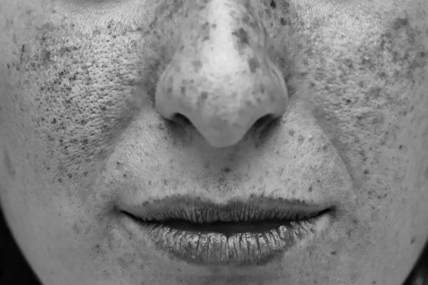 A close up view of a womans face. UV light on the cheeks, nose and lips. Showing damage and imperfections caused from spending too much time in direct sunlight