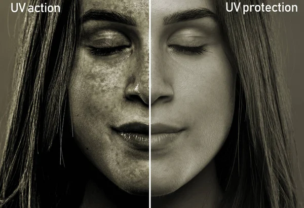 20代前半の少女の柔らかい顔に太陽の光の結果を示す分割画面 紫外線保護の有無にかかわらず皮膚の効果の後 — ストック写真