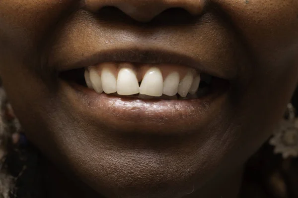 Una Vista Cerca Extrema Los Dientes Blancos Brillantes Una Mujer —  Fotos de Stock