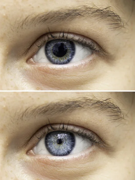 Human eye pupils size close up