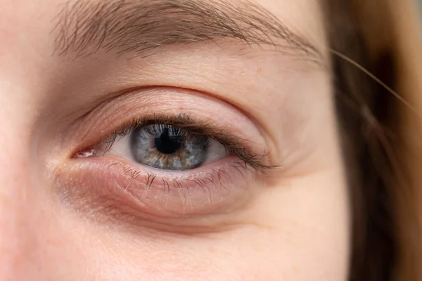 Mujer Con Ojo Gris Mirando Cámara — Foto de Stock