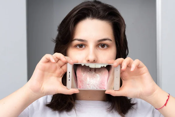 Girl Showing Magnified Image Her Tongue Candida Albi — Stock Photo, Image