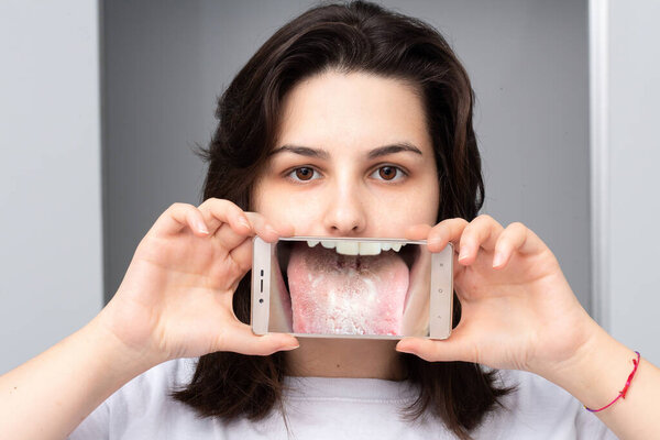 Girl showing the magnified image of her tongue with Candida albi