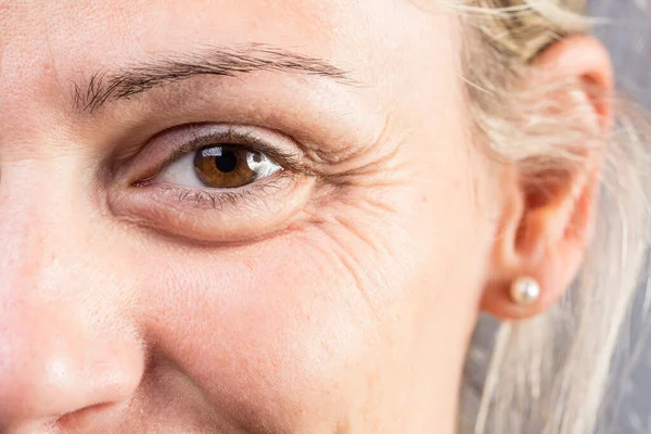 Wrinkled Eye Beautiful Lady — Stock Photo, Image
