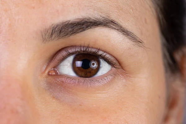 A macro view on the eye of a beautiful young woman with brown iris. Slight redness can be seen in the eyelids as she recovers from blepharitis, a bacterial infection.