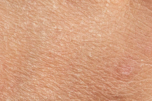 对高加索皮肤的线条和裂缝的近距离观察 因晒太阳而老化 需要保湿和皮肤科医生 — 图库照片
