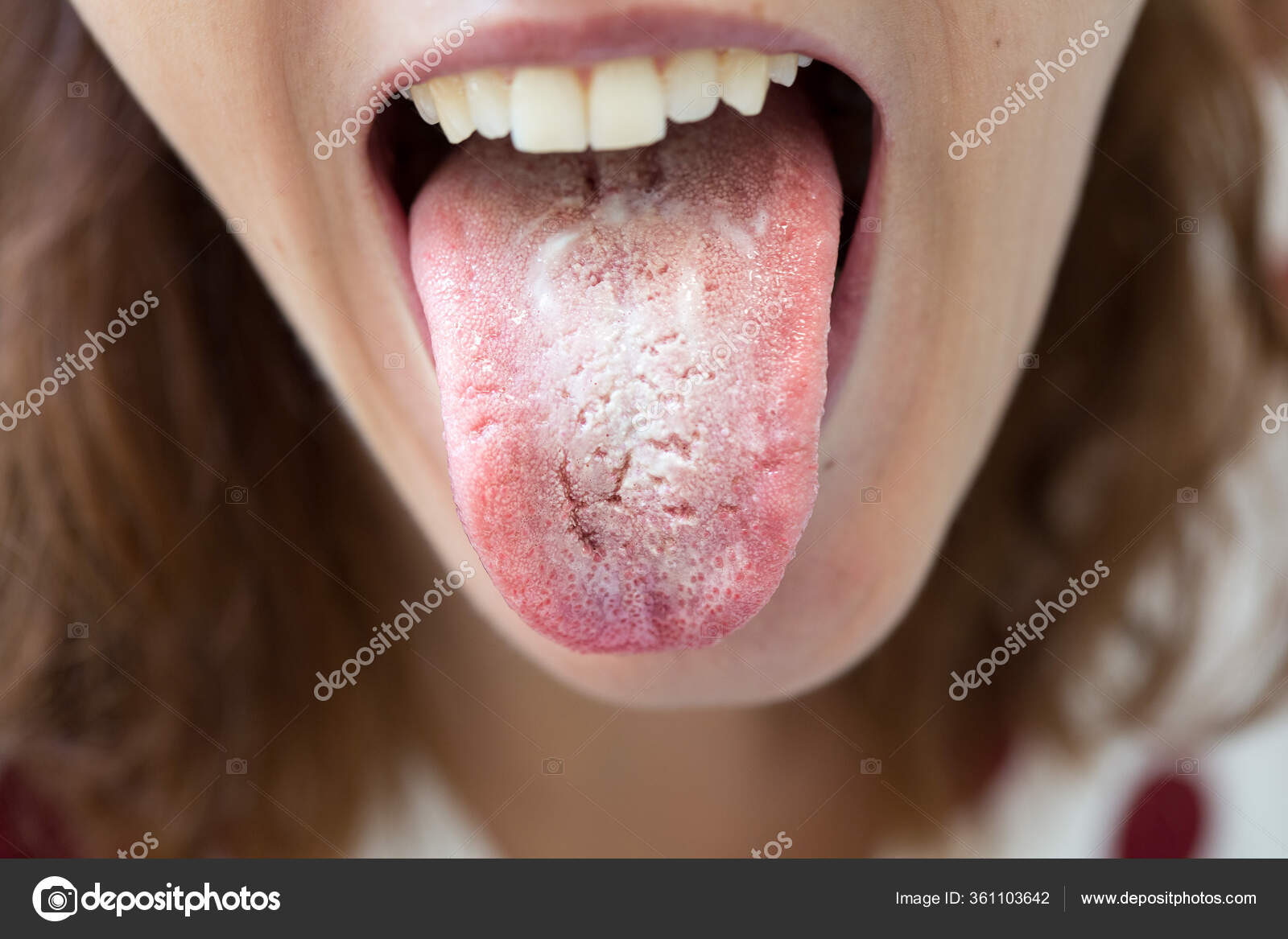 Girls Spitting Mouth