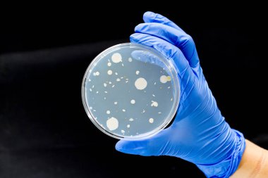 Petri kabını bakteri kültürü ile tutan araştırmacı