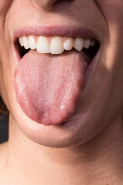 Kanadalı Albicanları tespit etmek için hastaneye gelen bir kız.