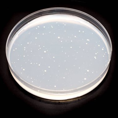 Bakteri kolonileri olan petri kabı