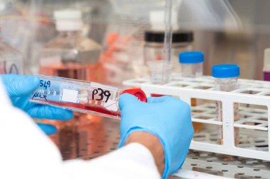 Kanser hücreli matara