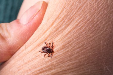  Bir insan kolunun cilt yüzeyinde kene yürüyüşü