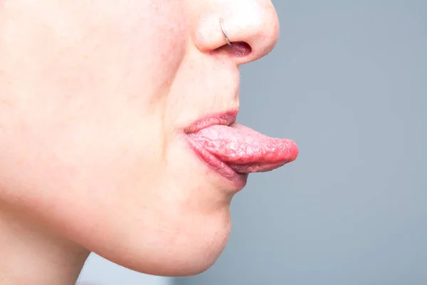 Mädchen Mit Ausgestreckter Zunge — Stockfoto