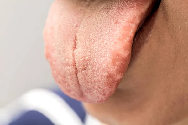 Tongue Out Mouth Woman — Stock Photo, Image