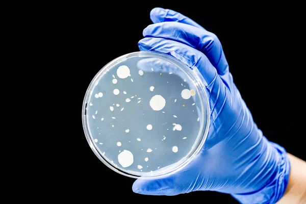 Hand Van Arts Met Petrischaal Met Bacteriën Agarcultuur — Stockfoto