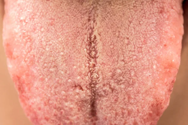 Macro Human Tongue — Stock Photo, Image
