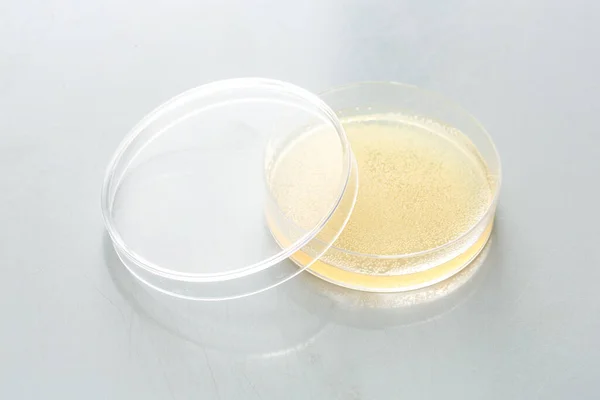 Petri dish with bacterial culture in agar