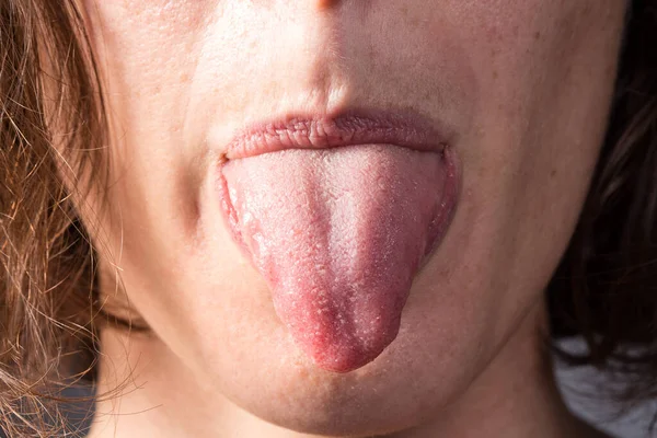 Dilini Gösteren Bir Kadın — Stok fotoğraf