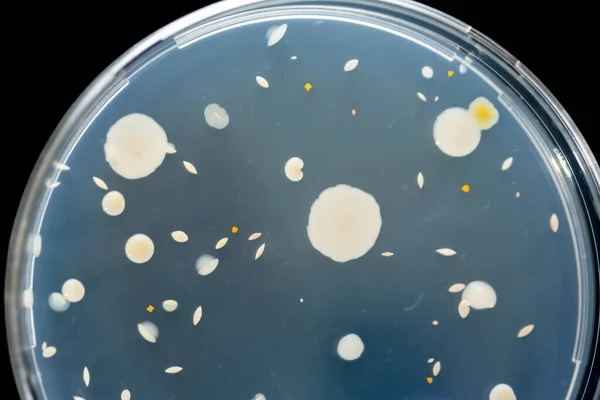 Macro Colonias Bacterias Cultivo Agar — Foto de Stock