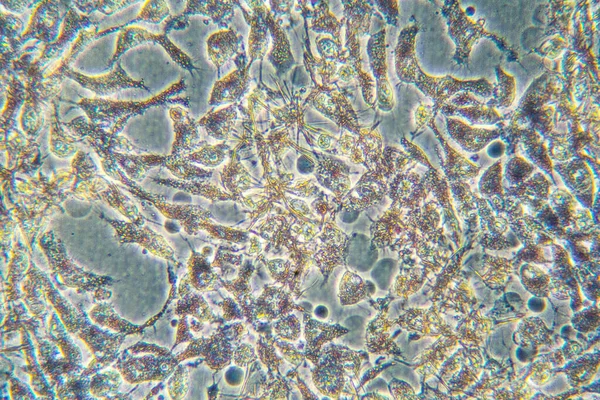 Células Cancerosas Humanas Microscopio — Foto de Stock