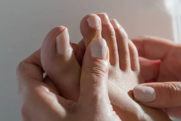 Caso Hiperidrose Palmoplantar Sudorese Sintomática Mãos Pés Uma Mulher — Fotografia de Stock