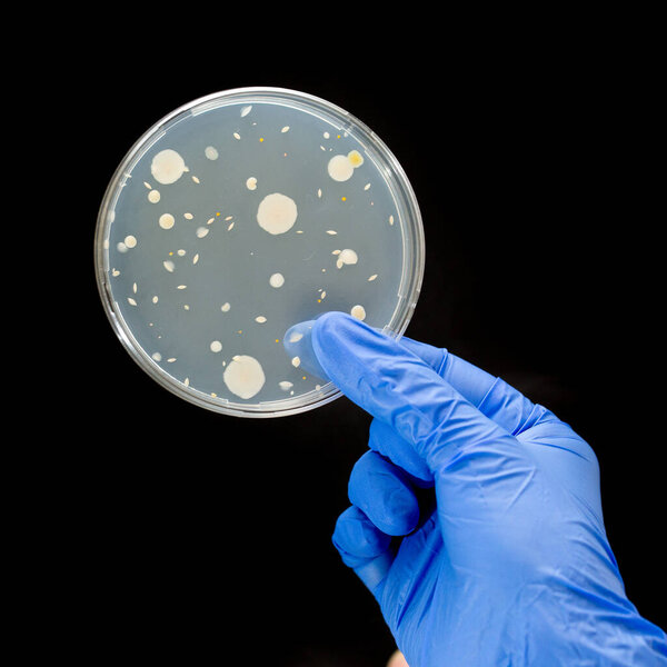 Hand with blue gloves holding bacterial culture