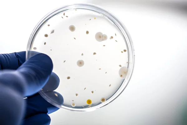 Wetenschapper Houdt Bacteriecultuur Agar — Stockfoto