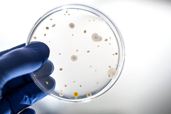 Hand of doctor with blue gloves holding test sample