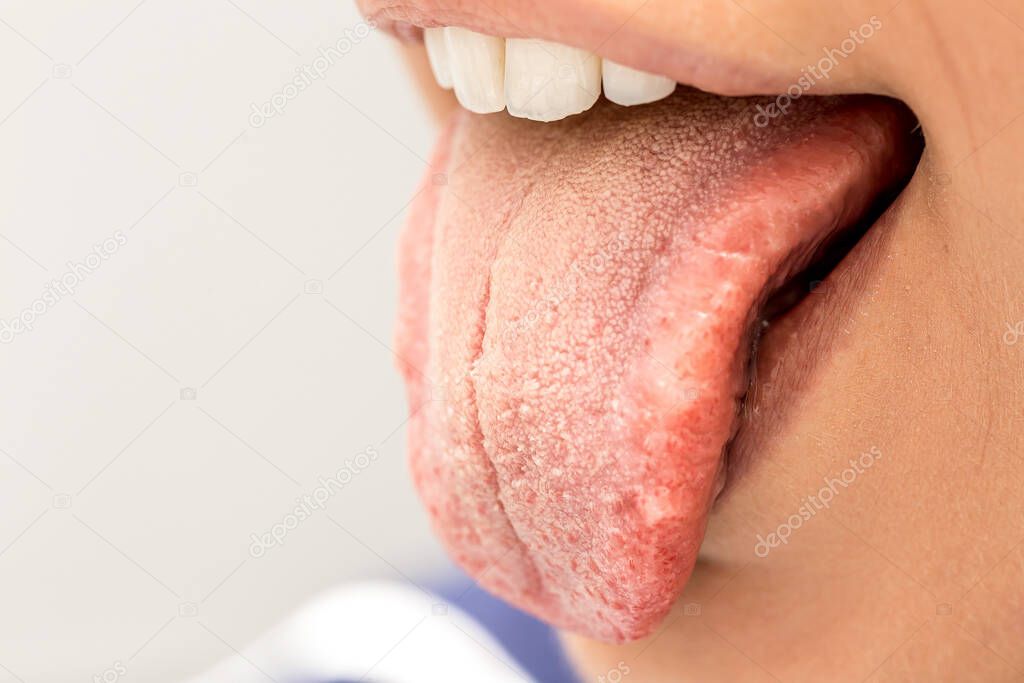 Tongue out of mouth of woman