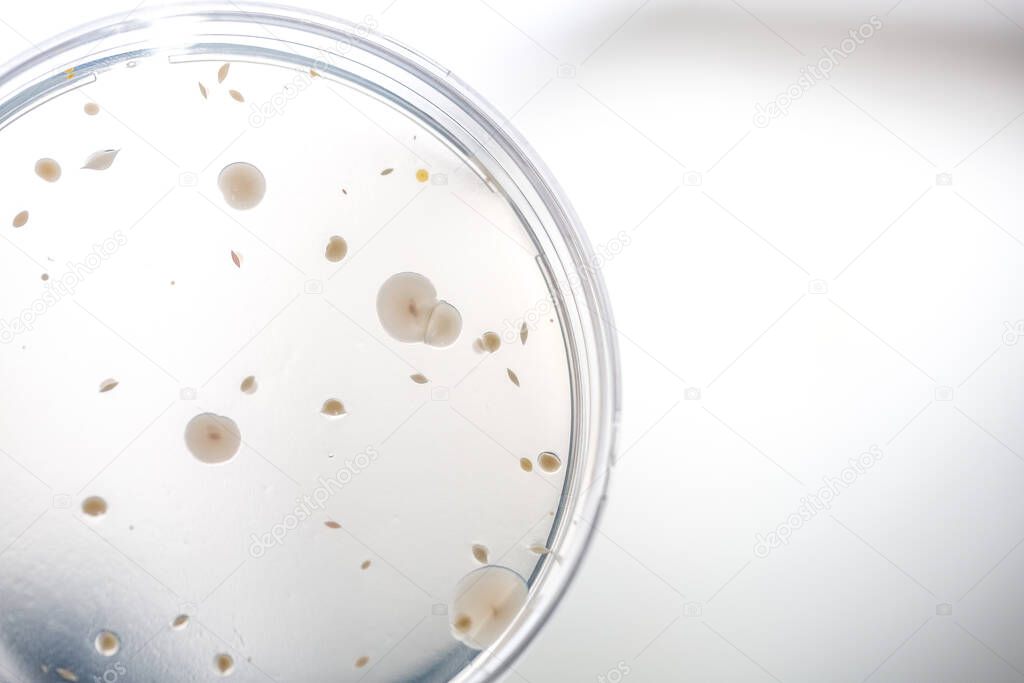 Close up of Petri dish with bacterial colonies