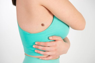 Turkuaz spor giyimli beyaz bir kadının yan görüntüsü. Derisindeki büyük bene odaklanmış. Güneşe maruz kalma etkisi, ultraviyole radyasyonun sağlık etkileri.