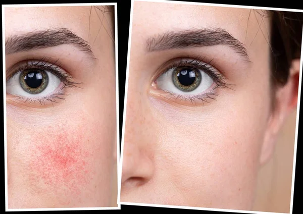 Collage Closeup Views Woman Eyes Comparison Beauty Care Intervention — Stock Photo, Image