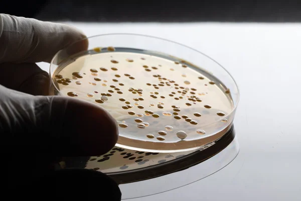 Ronde Laboratoriumapparatuur Met Kleurrijke Bacteriële Kolonies Petrischaaltje Hand Met Witte — Stockfoto