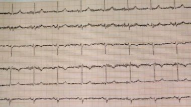 AKG test çıktı klinikte
