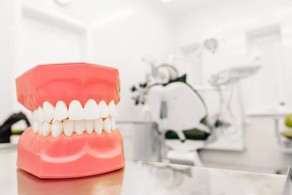 Modello in plastica dei denti sullo sfondo dello studio dentistico — Foto Stock