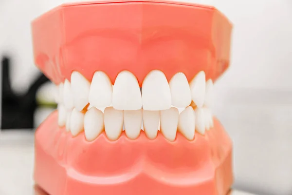 Modello in plastica dei denti nello studio dentistico. Primo piano — Foto Stock