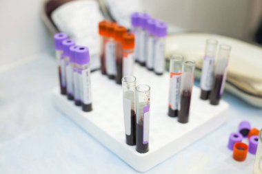  Laboratuvar test tüpleri gezici tıbbi kan nakli istasyonunda farklı kan örnekleriyle dolu. Hastalıklar ve virüsler için biyolojik sıvılar test ediliyor.