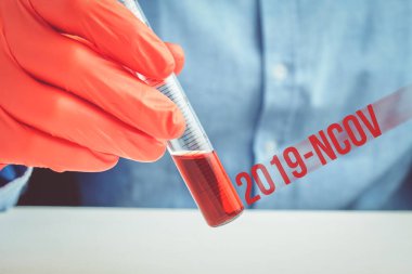 Doktor üzerinde 2019 ncov yazan bir test tüpü tutuyor. Virüs salgını konsepti. Kapat..