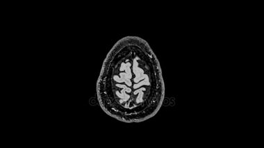 MRI beyin tarama, manyetik rezonans görüntüleme bir beyin, ultra hd 4k, zaman atlamalı