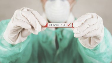 Coronavirus. 2019 nCoV için kanla test tüpü tutan tıp doktorunun ön planı.