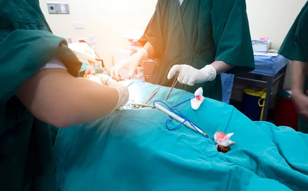 Midsection of surgery team operating Medical Team Performing Sur — Stock fotografie