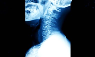 x-ray of the neck / Many others X-ray images