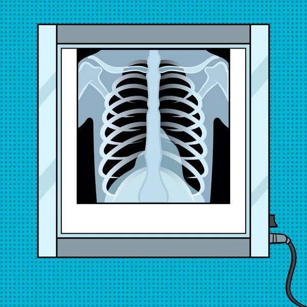Tórax de rayos X en negatoscopio pop art vector — Vector de stock