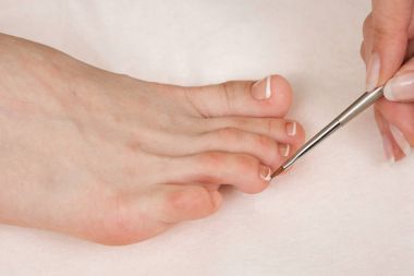 Doktor Podiatry Nasır, Mısır kaldırır ve tırnak batması davranır. Donanım manikür. Kavram vücut bakımı.