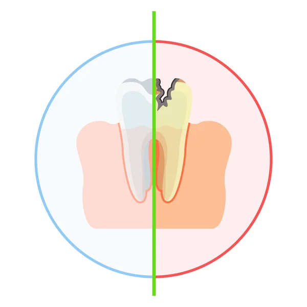 健康 vs 受损的牙齿 — 图库矢量图片