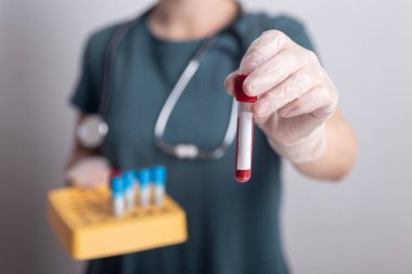 Doktor hemşirenin elinde kan testi tüpü fotokopi alanı ile sonuçlandı.