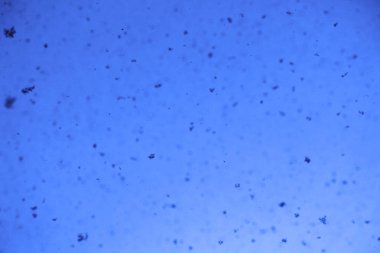 Kışın güneş ışığı önünde gökten kar düşüyor