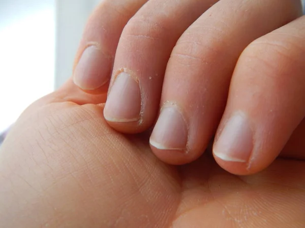 Detail van een hand, vingers en nagels — Stockfoto