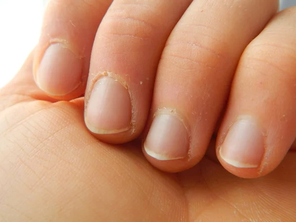 Detail van een hand, vingers en nagels — Stockfoto