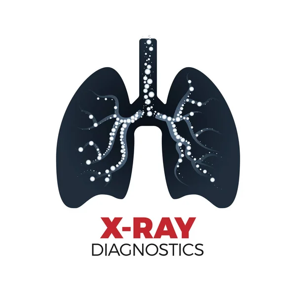 Concepto de diagnóstico por rayos X — Archivo Imágenes Vectoriales